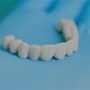¿En qué consiste la reconstrucción dental?