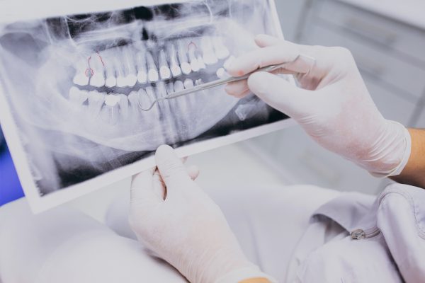 ¿Qué tipos de radiografías dentales existen?
